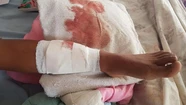 “Tenía miedo de que arrancaran un pedazo de pierna”