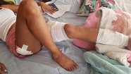 Dos pitbulls atacaron a un mujer en el barrio San José