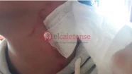 El pitbull mordió a su hijo y el sujeto mató a cuchillazos al animal.