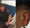 Fotos: a lo Tyson, le arrancó un pedazo de oreja a un policía a mordiscones