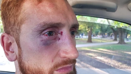 Increíble: hinchas de Peñarol atacaron a Alejandro Reinick, jugador de Quilmes