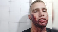 Tienen que operar al joven golpeado en Mr Jones: “Está descompuesto del dolor”