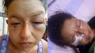 Acusó a su vecina de coquetear con su esposo y la atacó a trompadas y cuchillazos
