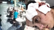 La moza fue salvajemente golpeada. 