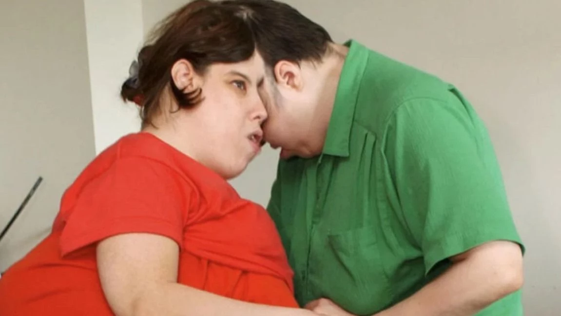 Murieron Lori y George Schappell: la pareja de siameses más longeva del mundo