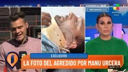 Las fotos y videos que muestran cómo quedó el hombre agredido por el novio de Nicole Neumann