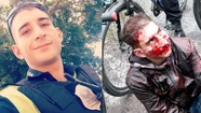Un motochorro le dio un balazo, pero igual lo corrió y lo detuvo a golpes: el ladrón era un policía