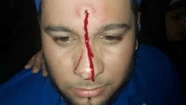 El cantante recibió un disparo de aire comprimido en la frente.