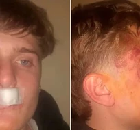 Otro brutal ataque de rugbiers: "Pudo ser como Fernández Báez Sosa" Otro brutal ataque de rugbiers: "Pudo ser como Fernández Báez Sosa"