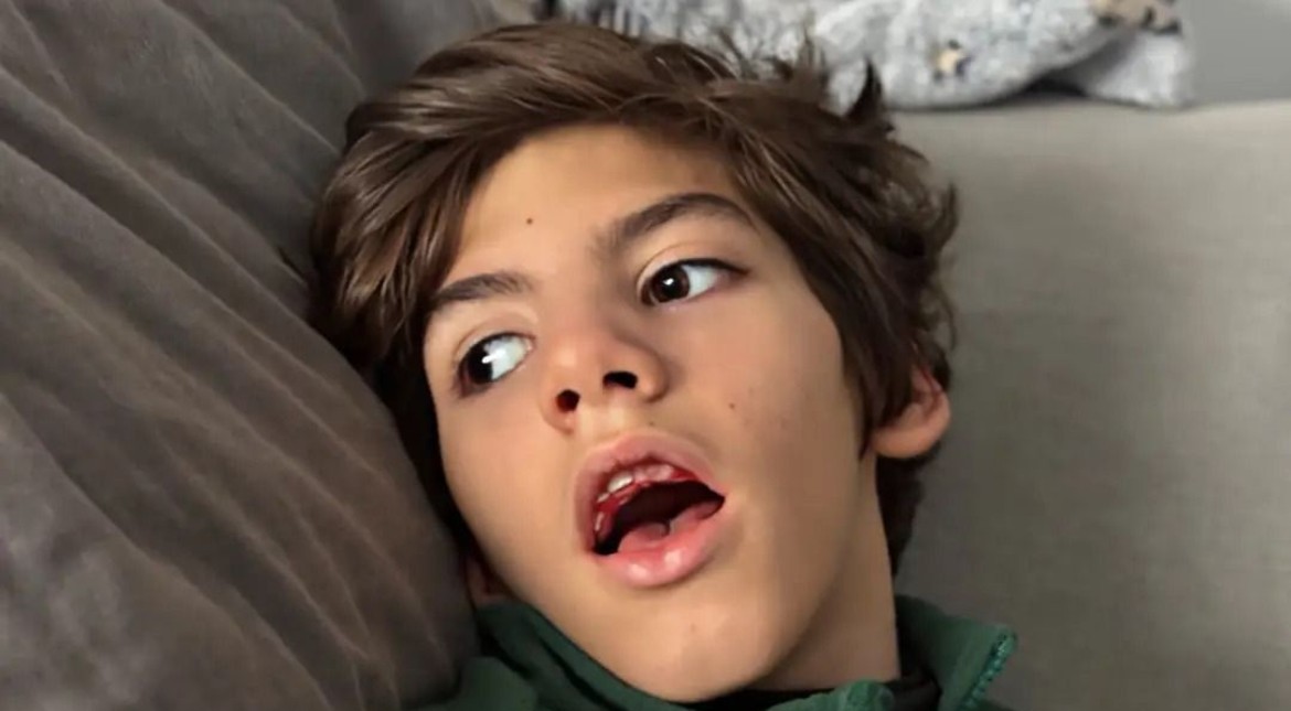 Lanzan una campaña para que un niño de 7 años con parálisis cerebral acceda a un tratamiento en la India