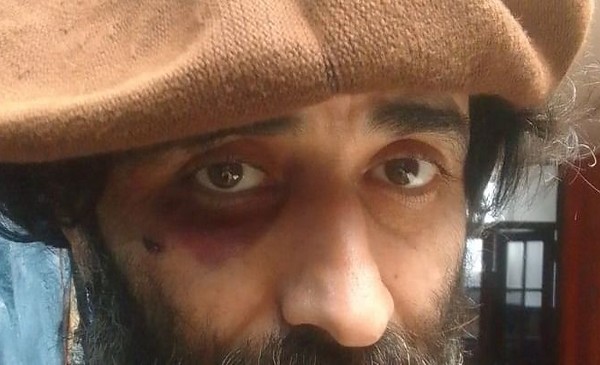 Asalto brutal en La Perla: víctima con heridas graves