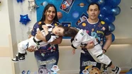 Arthur y Bernardo Lima, de tres años, estaban unidos por su cerebro y lograron ser separados.