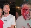 Un hombre fue brutalmente golpeado tras intentar sacarle una foto a Lionel Messi y a Antonela Roccuzzo 