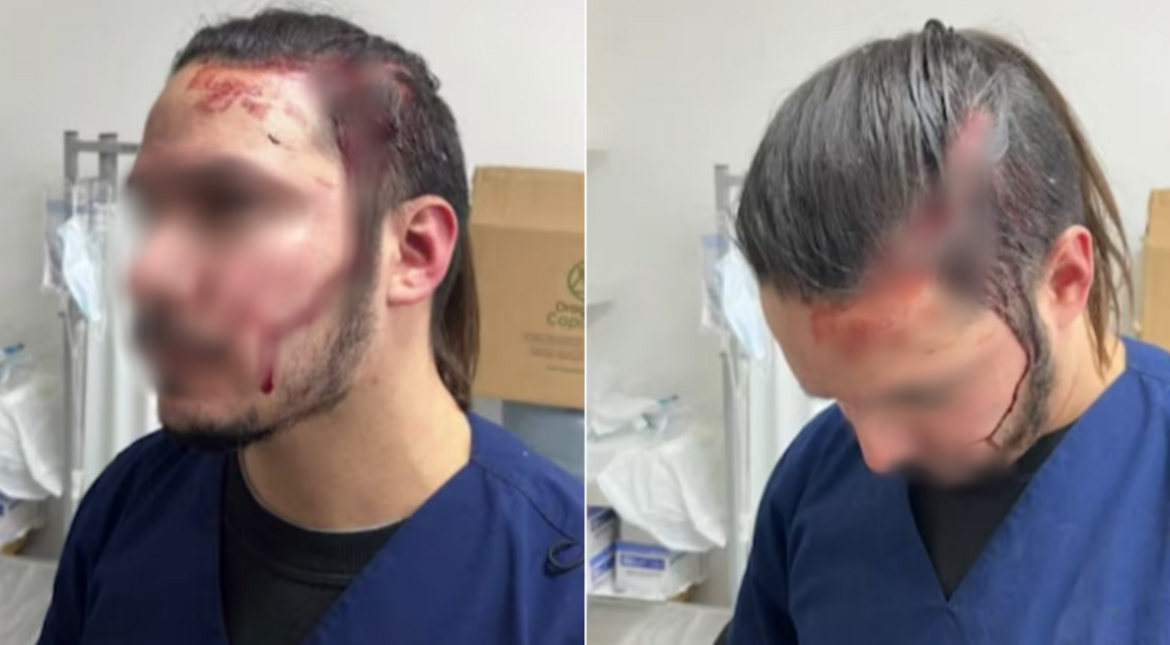 Su perra murió en una cirugía de castración y golpeó salvajemente al veterinario: "Quedó noqueado"