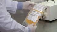 La tasa de letalidad de pacientes que recibieron plasma en hospitales bonaerenses es del 26%