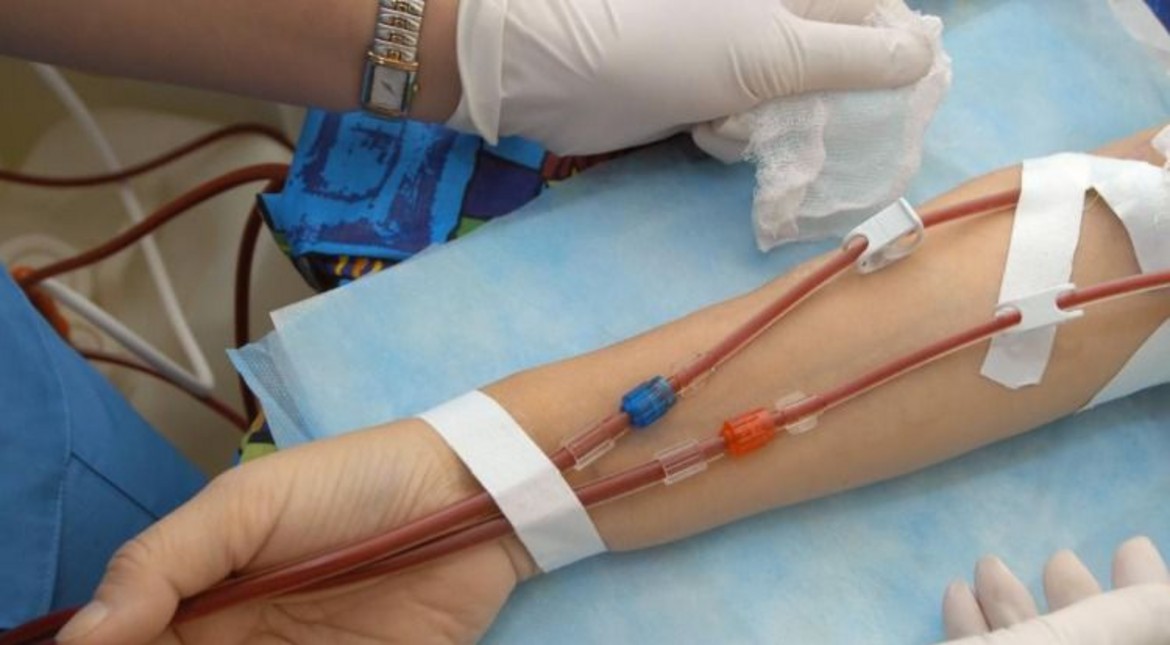Día Mundial de la Leucemia linfocítica crónica: el 89% de las personas diagnosticadas no reconocieron los síntomas