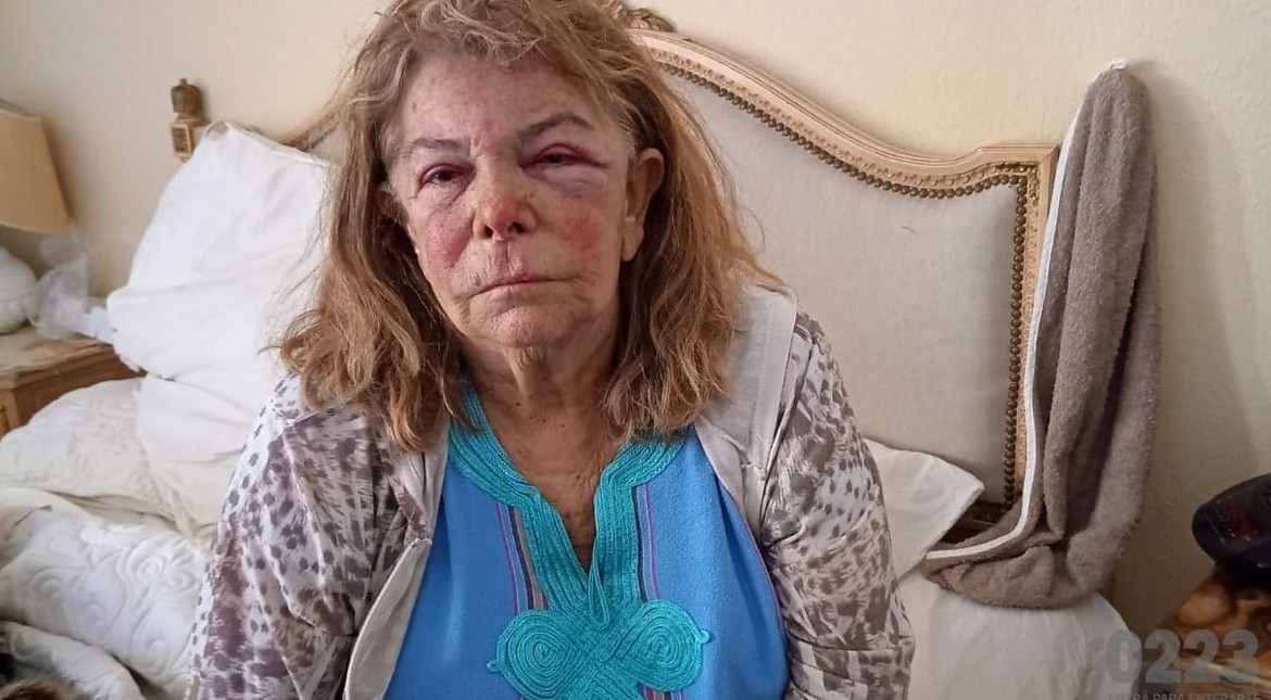 Terrible: la jubilada asaltada confirmó que la golpearon mientras dormía