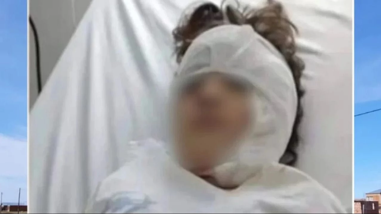 Tragedia en Río Gallegos: un pitbull atacó y desfiguró a una niña