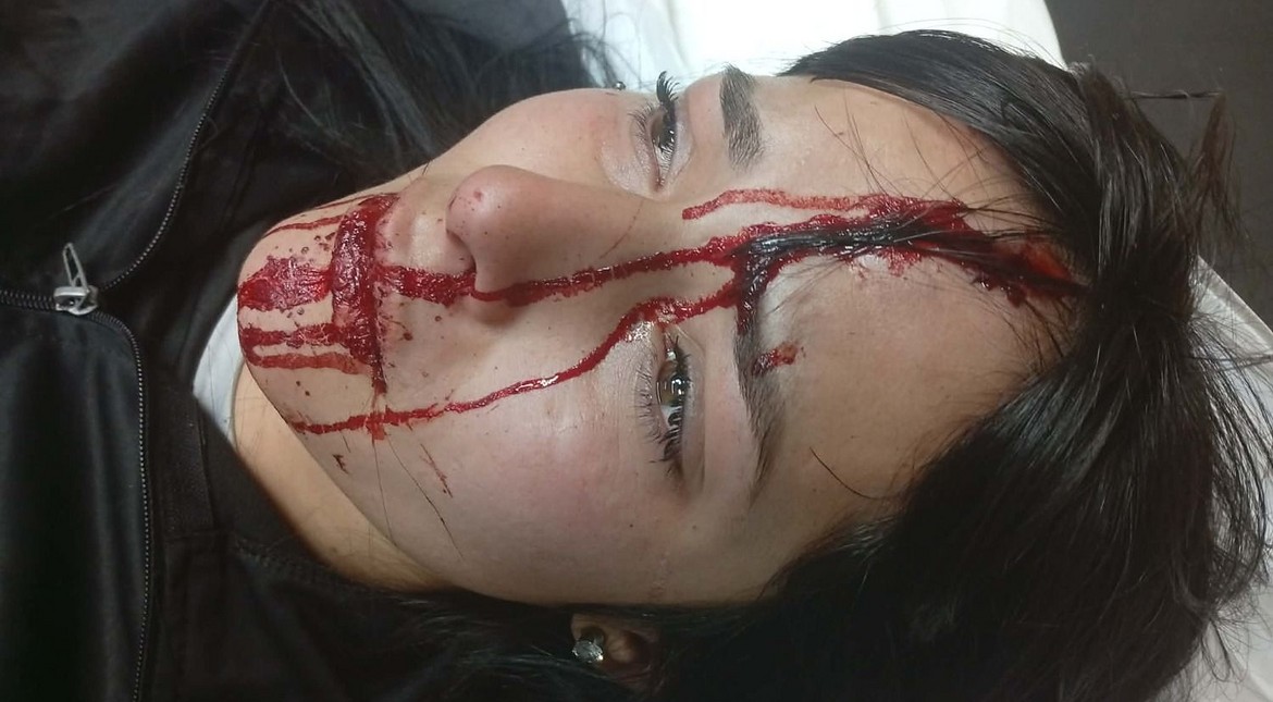 “Mami, me estoy desangrando”: su expareja la golpeó, la amenazó con un arma y le abrió la frente