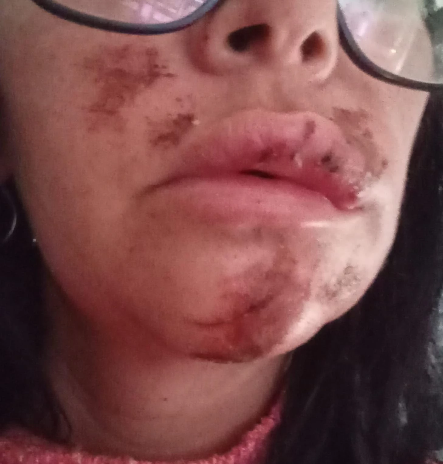 La joven sufrió múltiples heridas. 